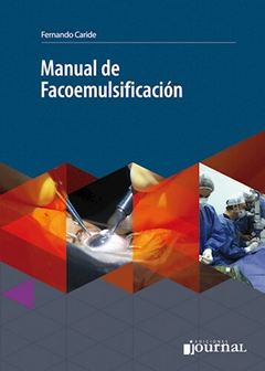 Manual de Facoemulsificacion - Fernando Caride - Ediciones Journal