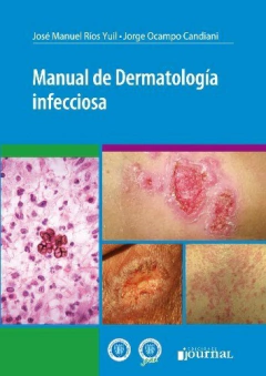 Manual de dermatologia infecciosa - Juan Manuel Rios Yuil - Ediciones Journal