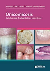 Onicomicosis - Tosti/Vlahovic/Arenas - Ediciones Journal