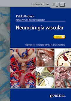 Neurocirugia vascular - Pablo Rubino - Ediciones Journal