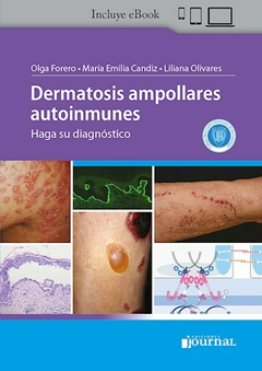 Dermatosis ampollares autoinmunes