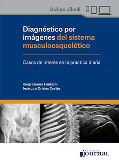 Diagnostico por imagenes del sistema musculoesqueletico - Fujikami - Ediciones Journal