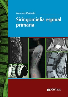 SIRINGOMIELIA ESPINAL PRIMARIA - JUAN JOSE MEZZADRI - EDICIONES JOURNAL