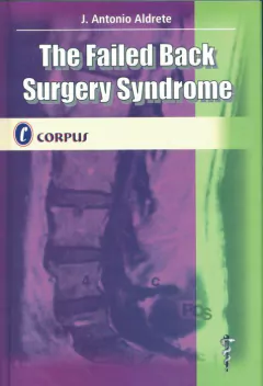 THE FAILED BACK SURGERY SYNDROME - ALDRETE - CORPUS