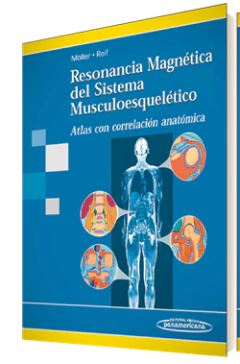 Resonancia Magnetica del sistema musculoesqueletico - Moller/Reif - Editorial Medica Panamericana