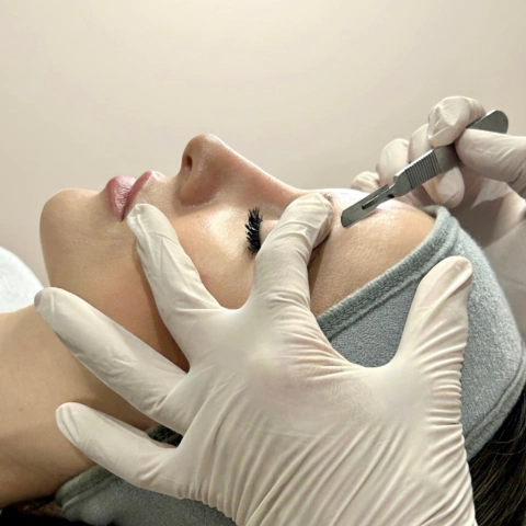 SESIÓN: Dermaplaning + Peeling Natural - comprar online