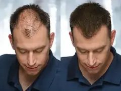 fibra capilar 27.5g AOB alley of barbers castanho escuro maquiagem para o cabelo queratina em po natural lacrada na internet